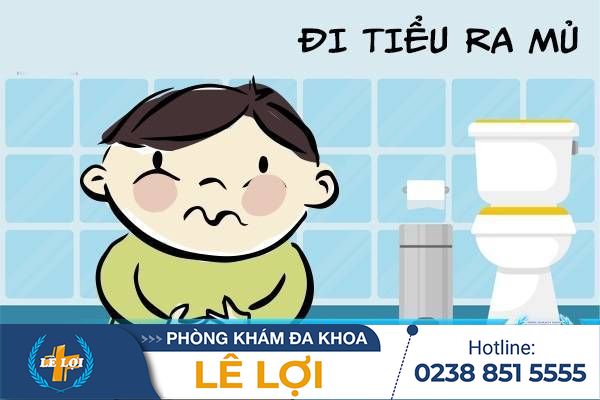 Tiểu ra mủ dấu hiệu bệnh không nên chủ quan